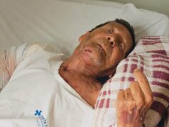 Morte de idoso após cirurgia no braço levanta suspeita da família, mobiliza investigação e manifestação no domingo (29)