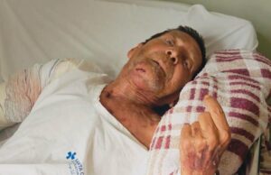 Morte de idoso após cirurgia no braço levanta suspeita da família, mobiliza investigação e manifestação no domingo (29)
