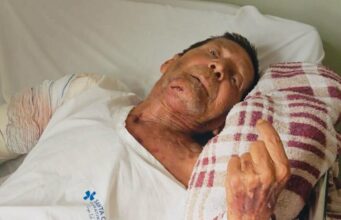 Morte de idoso após cirurgia no braço levanta suspeita da família, mobiliza investigação e manifestação no domingo (29)